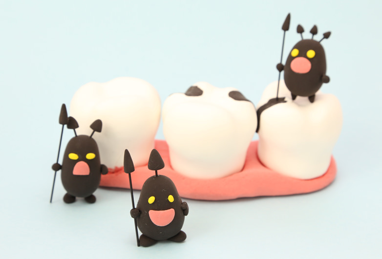 極力削らないむし歯治療