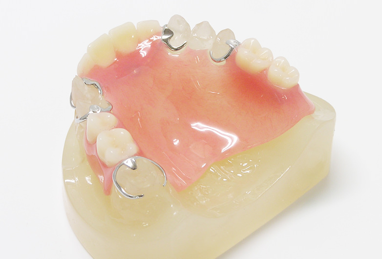 保険適用の入れ歯