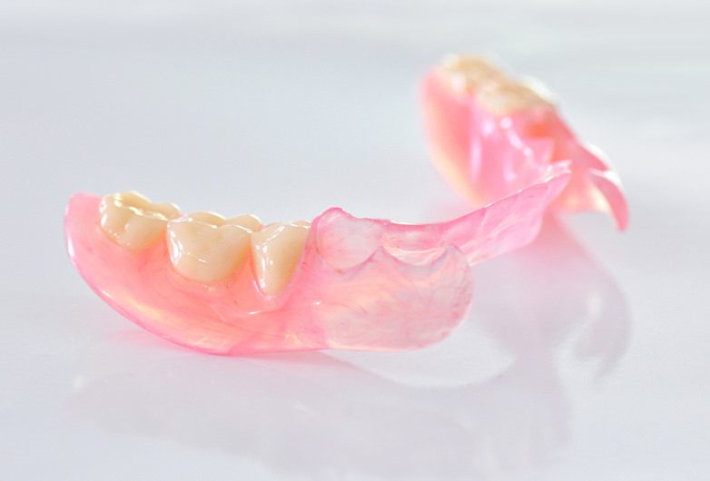 ノンクラスプデンチャー