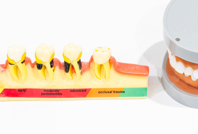 いつまでも自分の歯で健康に過ごすために